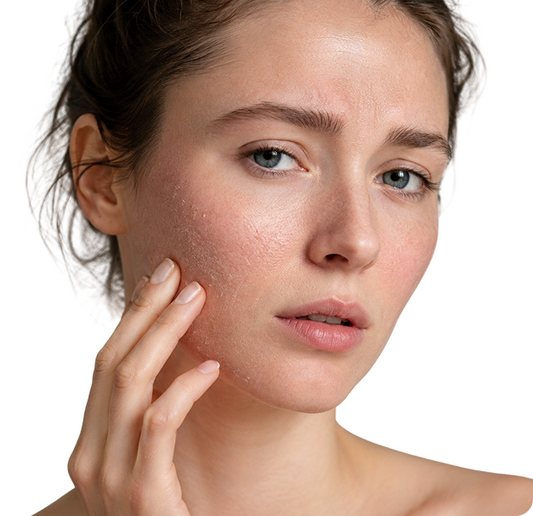 Acne Scars: Prevention vs. Treatment (Real Talk)