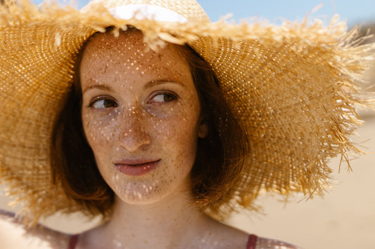Seasonal Acne: Why Summer/Winter Breaks You Out