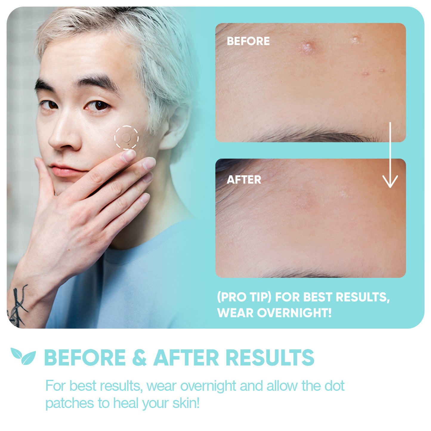 Emergency Dots with Tea Tree Oil