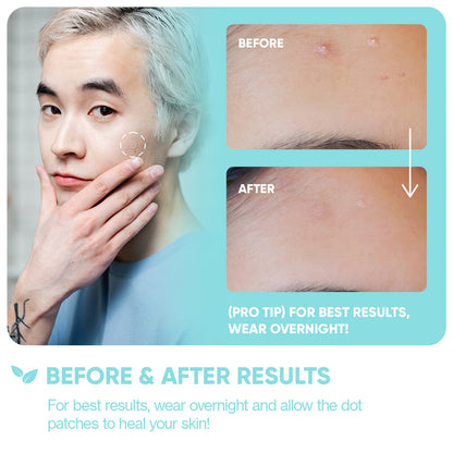 Emergency Dots with Tea Tree Oil