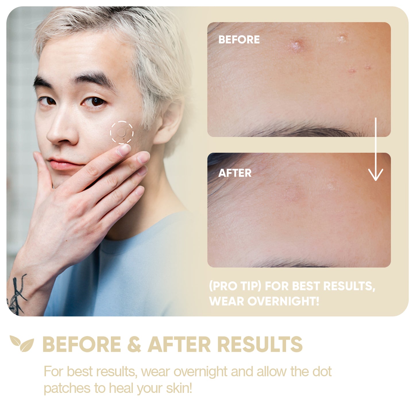 Emergency Dots with Niacinamide + Zinc