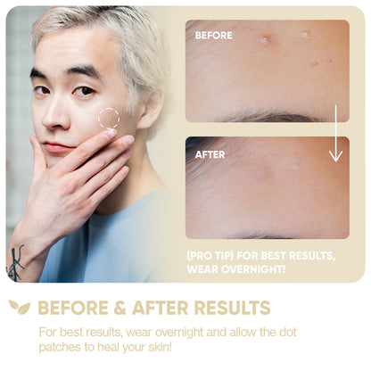 Emergency Dots with Niacinamide + Zinc