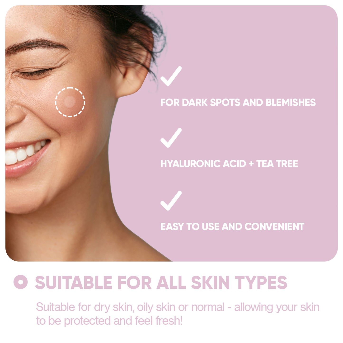 Micro Needle Patches for Dark Spots