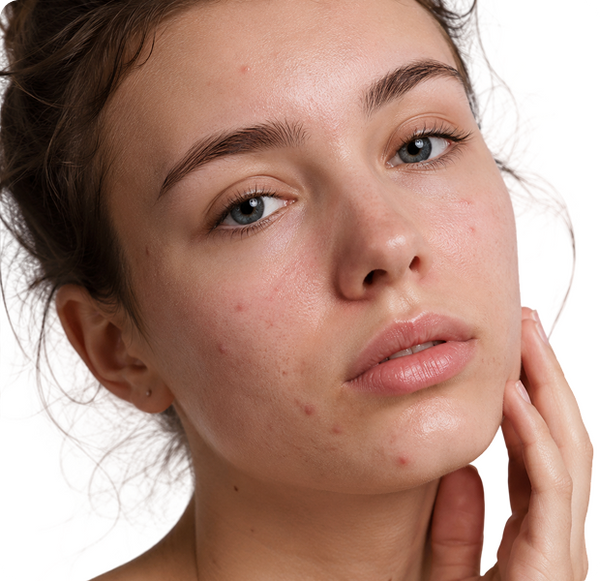 Breakouts & Spots